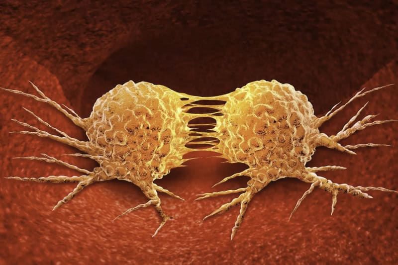 cellule-tumorali-tumori_cancro